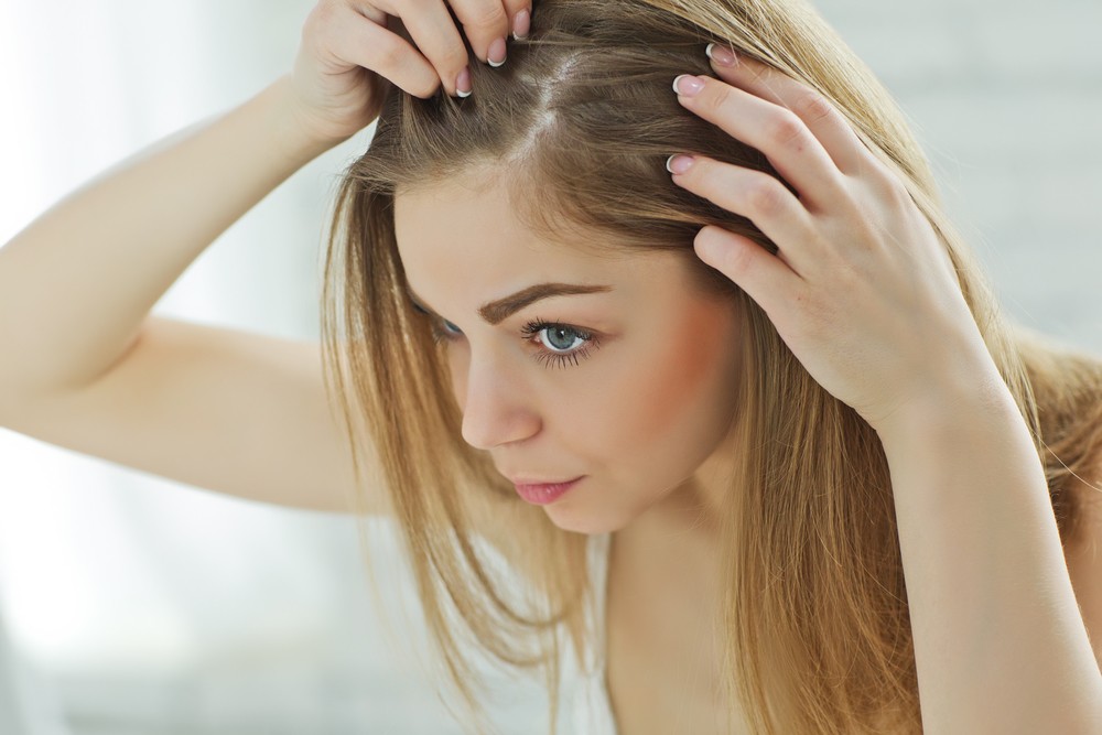 Female hair loss, explaining the Gender Gap | Hair Loss | Julian Jay Julian  Jay Hair & Scalp Clinic